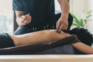 Jak działa i na co pomaga akupunktura?