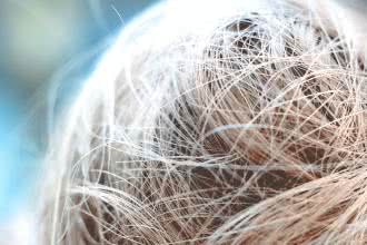 Zapalenie mieszków włosowych – domowe sposoby. Kiedy pójść do lekarza?