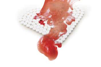 Aspiryna - brać czy nie?