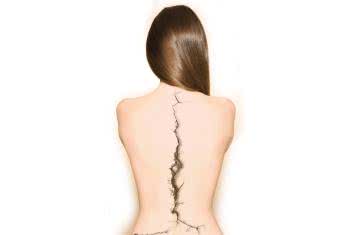 4 ukryte przyczyny bólu pleców