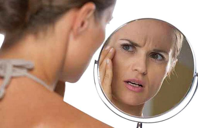 Plamy na twarzy, przebarwienia i ostuda - co robić?