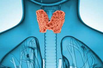 chorobą Gravesa– Basedowa