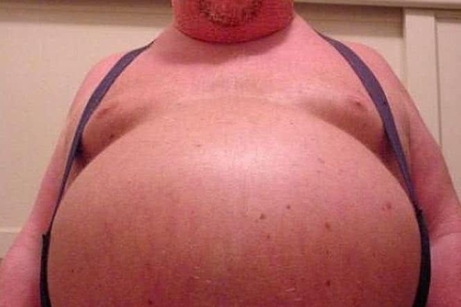 Masz brzuch piwny? Grozi Ci nagła śmierć sercowa!