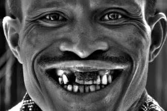 Biedni mają o 8 zębów mniej niż bogaci