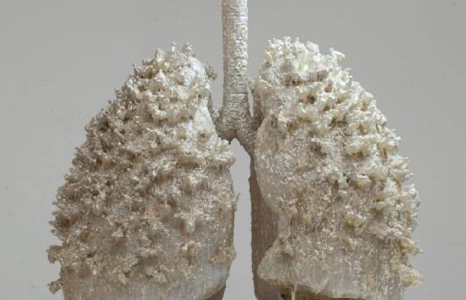 Spirometria - sposób na wykrycie chorób płuc