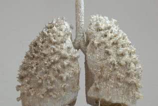Spirometria - sposób na wykrycie chorób płuc