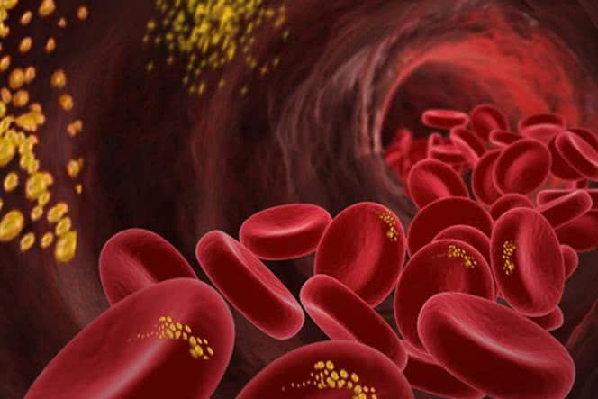 Jaki jest prawidłowy poziom cholesterolu? Zmieniające się normy na przestrzeni lat.