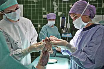 Podwójna replantacja obciętych dłoni