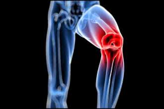 Ryzykowna artroskopia kolana