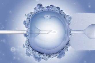In vitro może zwiększać ryzyko raka jajnika