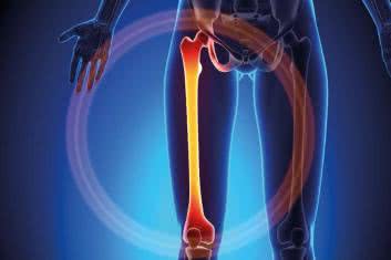 Filary mocnych kości