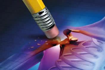 Osteoporoza po lekach