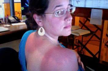 Naturalne filtry i opatrunki