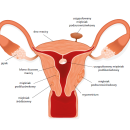 Mięśniaki macicy - czy operacja zawsze jest konieczna?