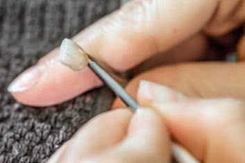 Licówki nie dla każdego