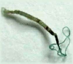 Włosogłówka Ludzka