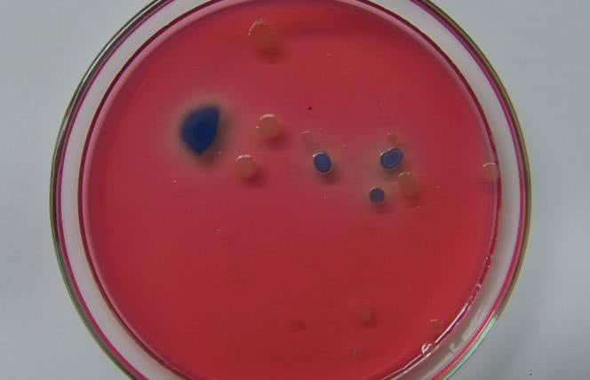 Niewygodna Prawda czyli globalny problem oporności mikrobów