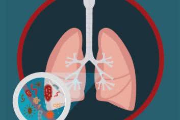 Co siedzi w płucach?
