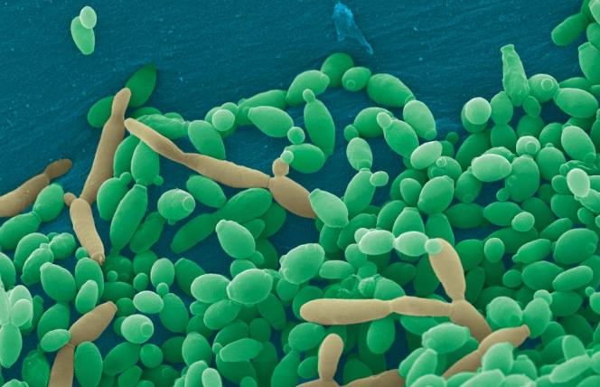 Choroba Leśniowskiego-Crohna: winne drożdżaki?