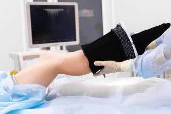 Rozpraw się z żylakami