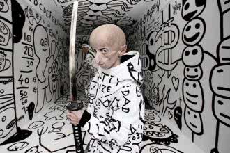 Progeria (przedwczesne starzenie) - objawy i leczenie