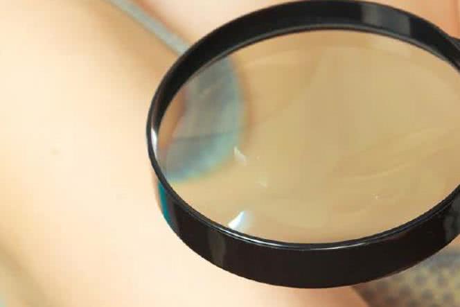 Jak zbudowana jest skóra?