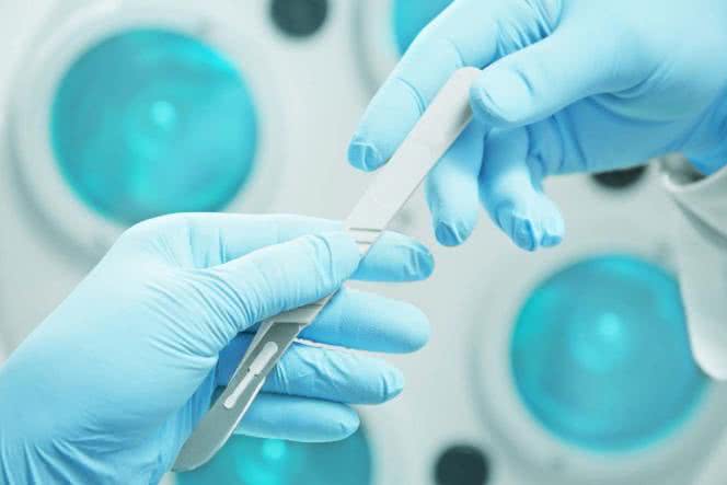 Mięśniaki macicy i histerektomia