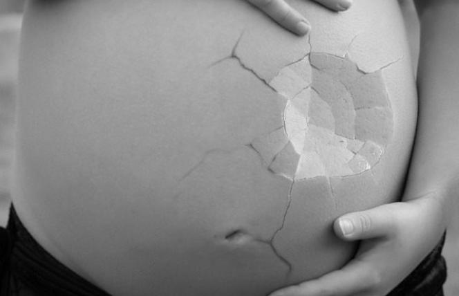 Raka nerki w czasie ciąży można leczyć