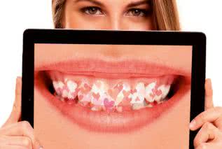 Serce i dziąsła - niebezpieczny związek?