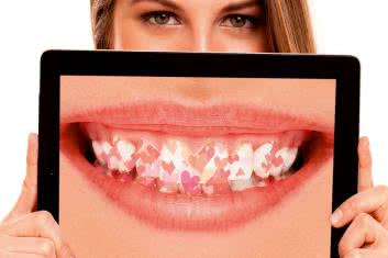 Serce i dziąsła - pomijany związek?