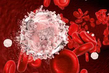 Czy białaczki można uniknąć