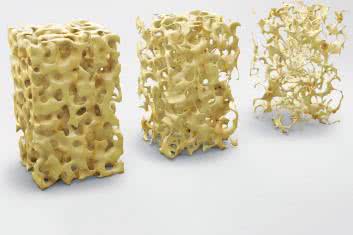 Kości w sieci powiązań