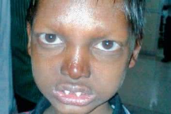 Jak postać z horroru