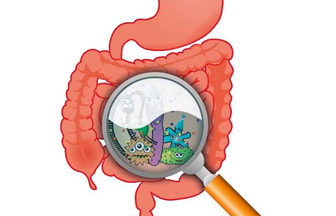 Zespół jelita drażliwego: dieta FODMAP