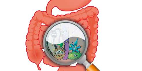 Zespół jelita drażliwego: dieta FODMAP