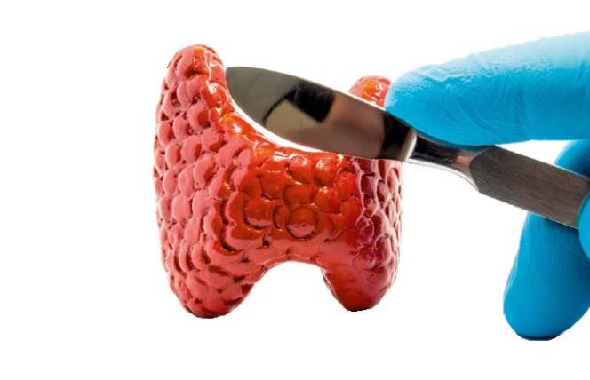 Wycięcie tarczycy: suplementy i dieta