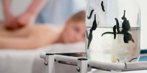 Hirudoterapia - na co pomaga leczenie pijawkami? 