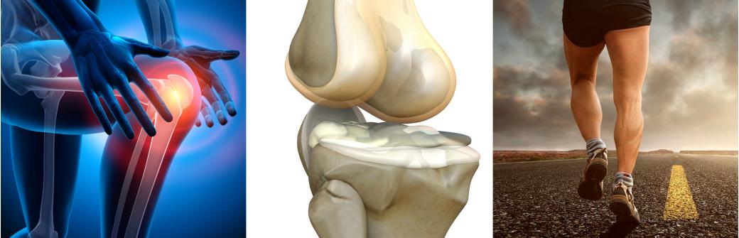 Zwyrodnienie stawów - leczenie niechirurgiczne, komórki mezenchymalne 