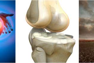 Zwyrodnienie stawów - leczenie niechirurgiczne, komórki mezenchymalne 