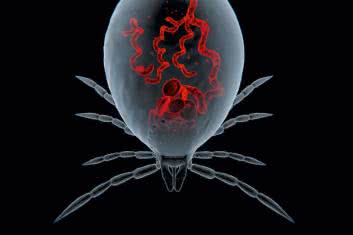 Zakleszczony układ nerwowy