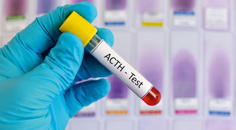 Próbka krwi w laboratorium 