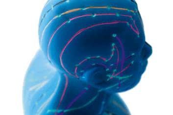 Szum w uszach? Utrata słuchu? Akupunktura!