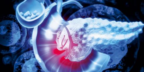 Trzustka - objawy choroby, dieta, zioła