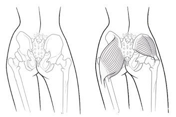 Wcale nie potrzebujesz endoprotezy 