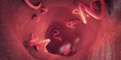 Pasożyty - domowe sposoby leczenia