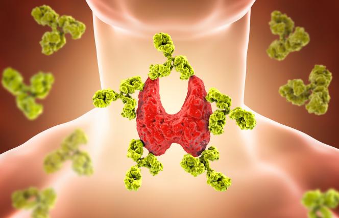 Niedoczynność i nadczynność tarczycy