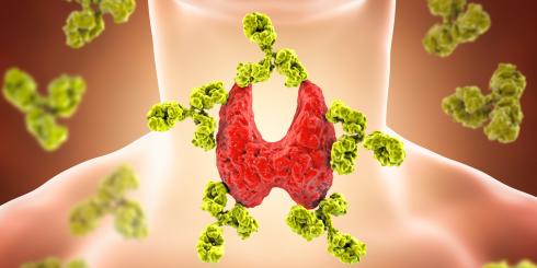 Niedoczynność i nadczynność tarczycy