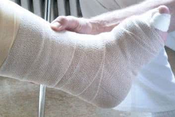 Terapia wtórnego obrzęku limfatycznego kończyny dolnej