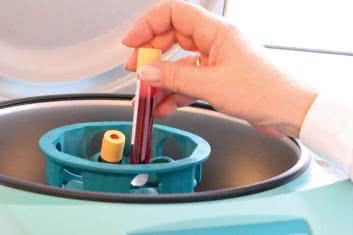 Jak diagnozuje się miażdżycę?