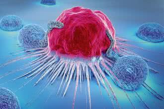 Co zamiast chemioterapii? Czy wirus odry może leczyć raka?